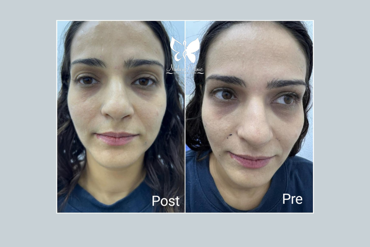 عيادة فيلر في الغردقة